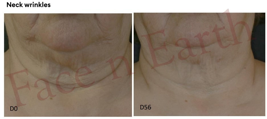 New All-in-One Serum Introductory Price