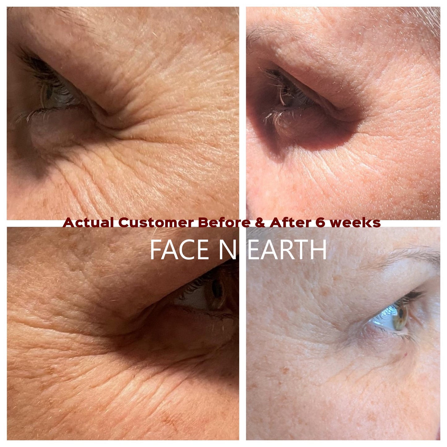 Skin Tight Extra Serum - Facenearth