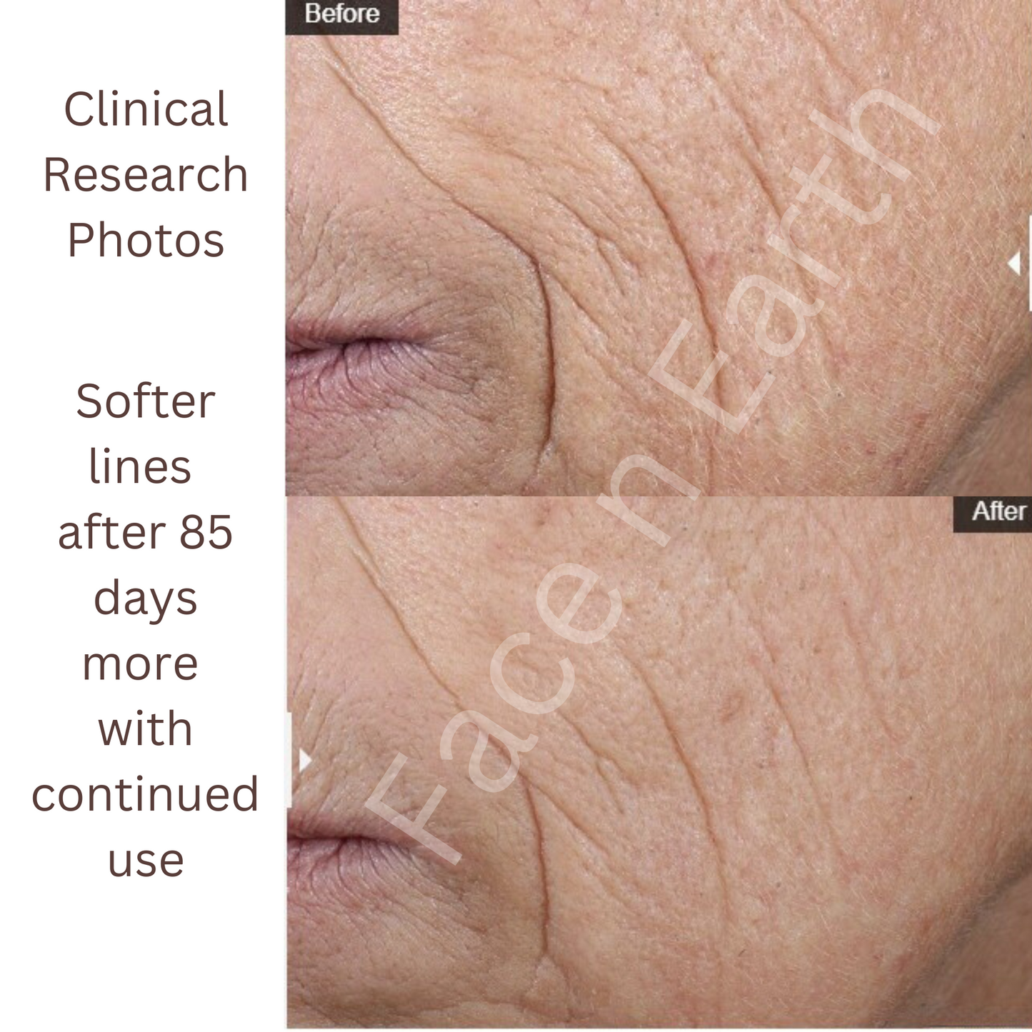 Skin Tight Extra Peptide Serum 5 powerful peptides including collagen
