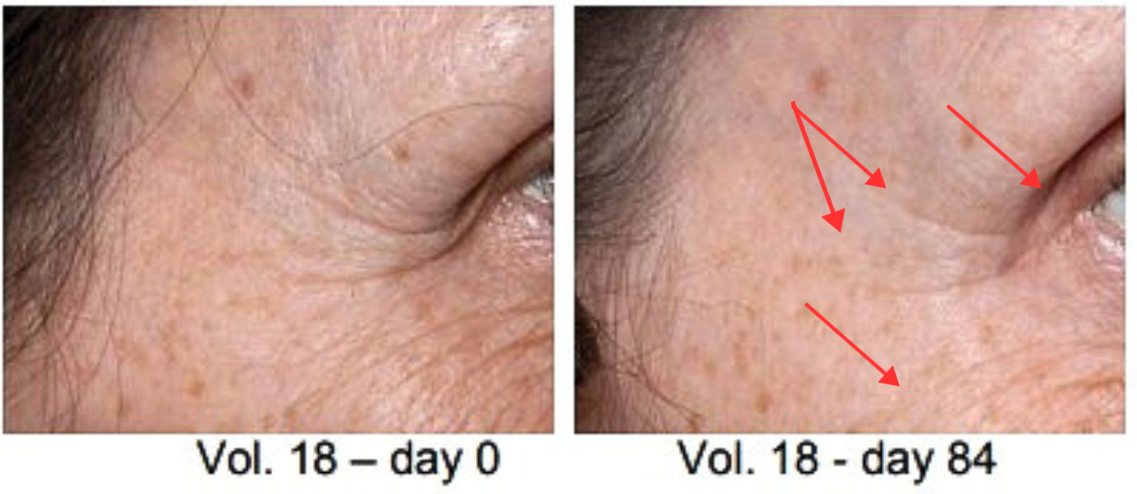 Skin Tight Extra Serum - Facenearth
