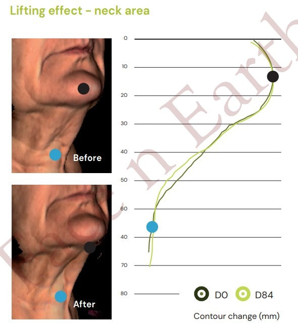 New All-in-One Serum Introductory Price