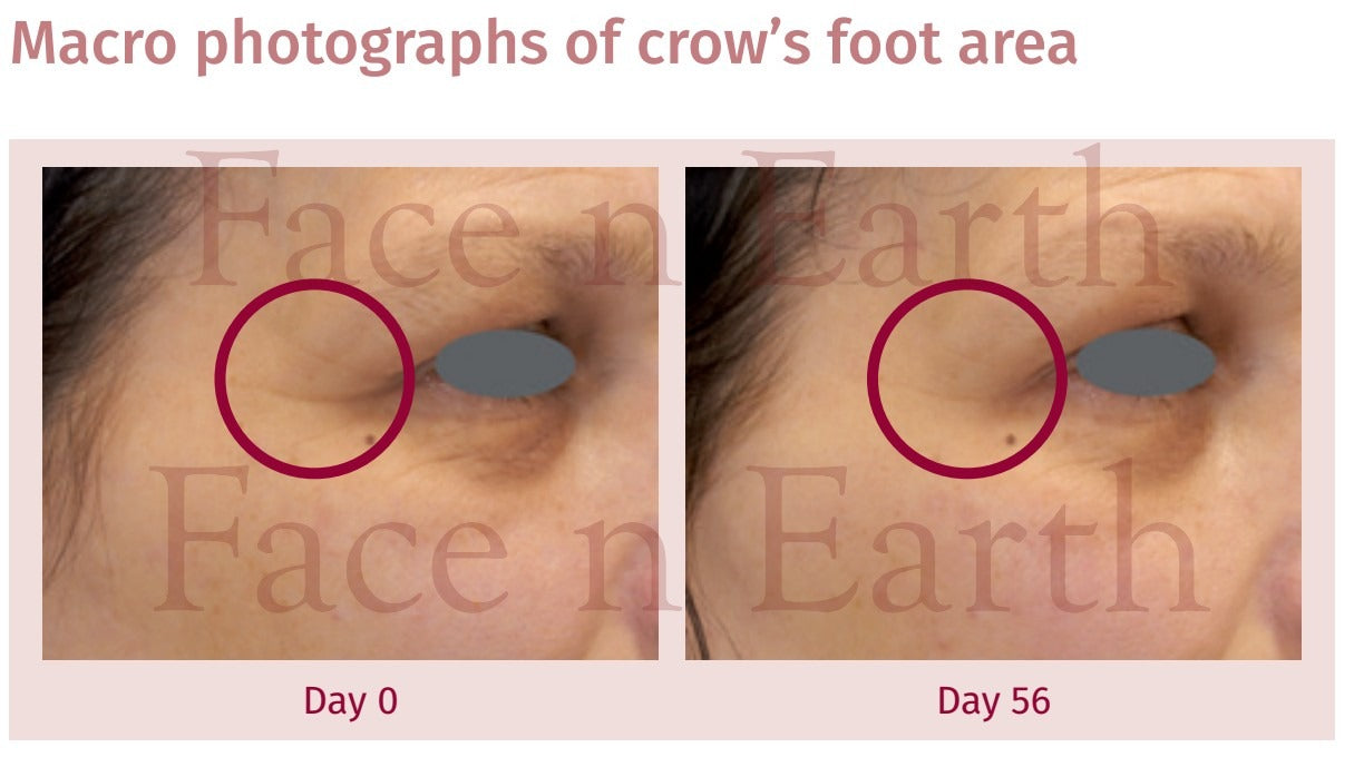 New All-in-One Serum Introductory Price