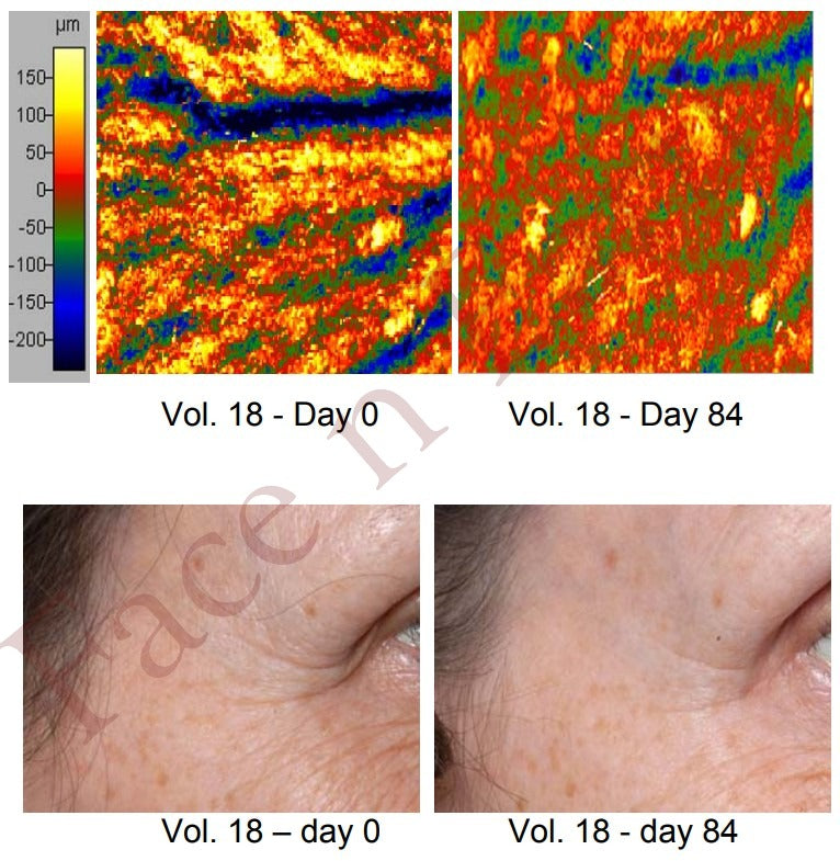 New All-in-One Serum Introductory Price