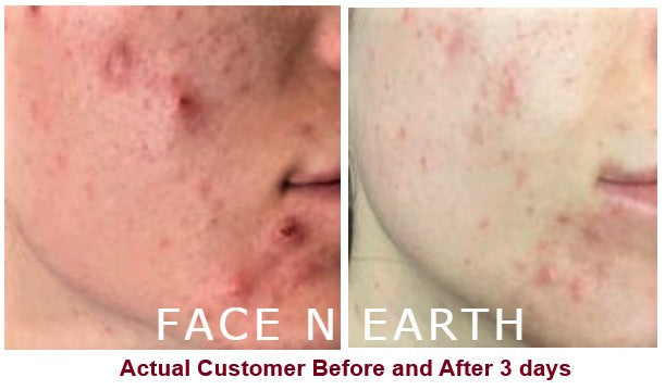 Colloidal Silver Green Tea & Chamomile Cleanser - Facenearth