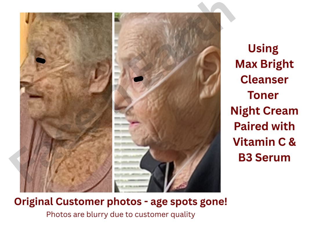 Max Bright Night-time Cream MSM, Vit C, Licorice - Facenearth