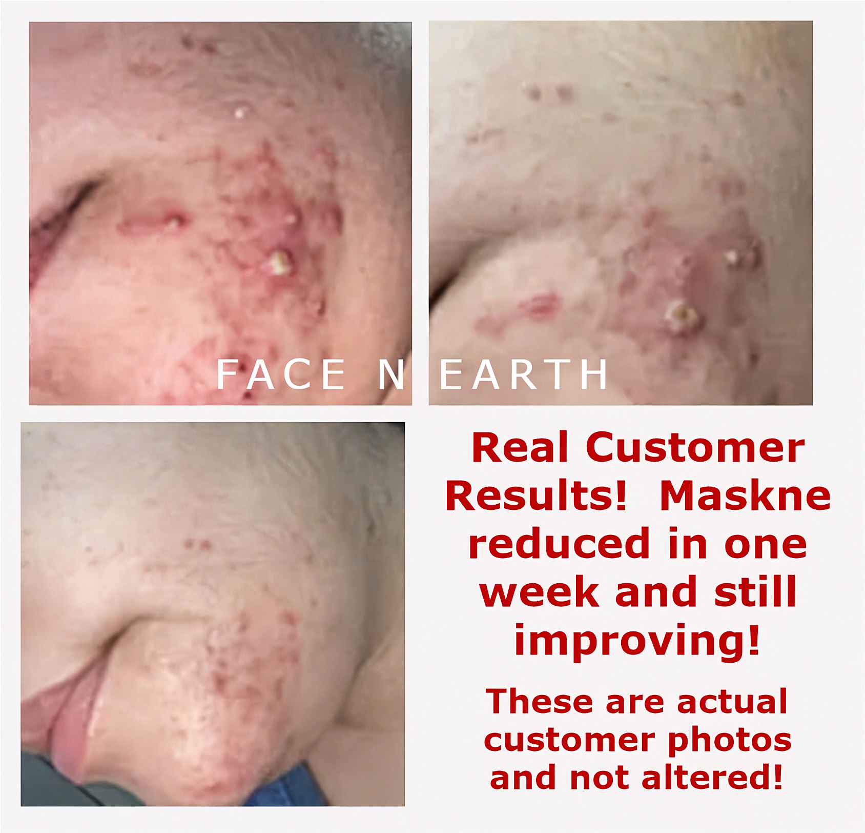 Niacinamide Vitamin B3 Oil-Free Cream - Facenearth