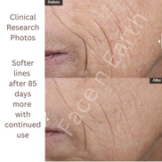 3x Stem Cell Recovery Spray - Facenearth