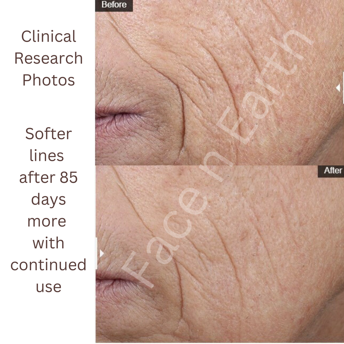 3x Stem Cell Recovery Spray - Facenearth