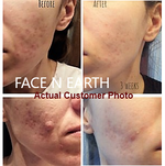 Load image into Gallery viewer, Blemish Comfort Serum - SPECIAL PRICE
