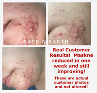 Blemish Comfort Serum