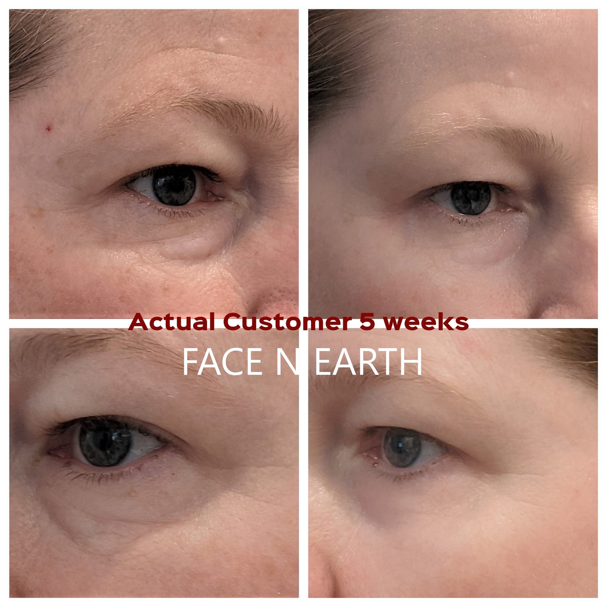 Orchid Stem Cells & Peptides Eye Serum - LOW STOCK